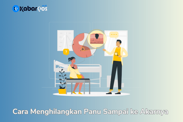 Cara Menghilangkan Panu Sampai ke Akarnya Terbaru 2023